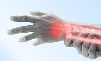 Ilustrácia témy Osteoporóza